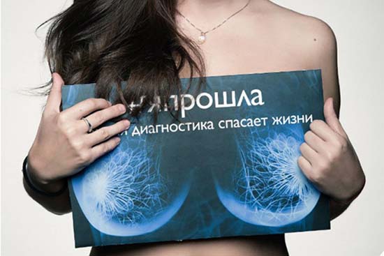 МРТ молочных желез во Владимире