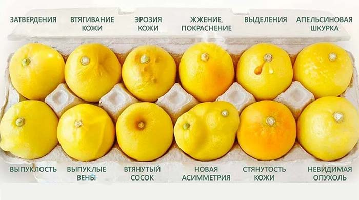 Симптомы, указывающие на возможное развитие РМЖ